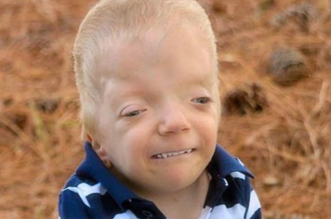 La madre que lucha contra los memes que se burlan de su hijo de 3 años gravemente enfermo