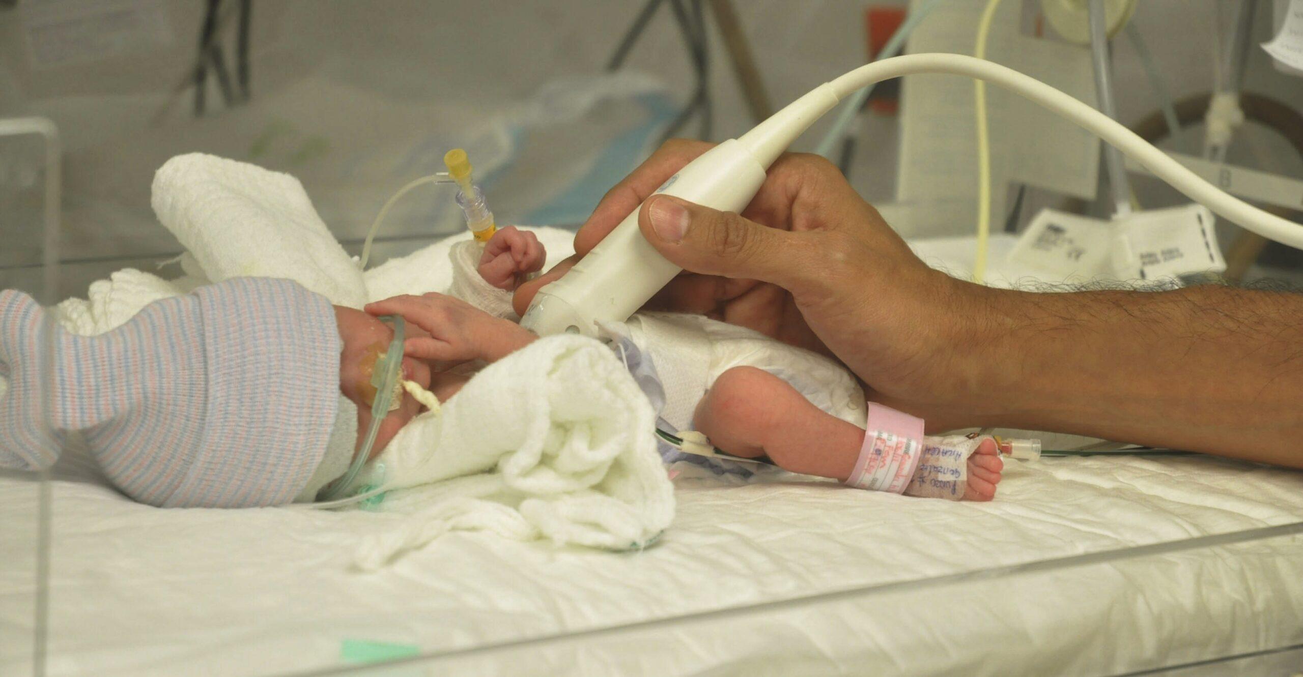 Detectan brote de infección sanguínea en 52 pacientes de hospitales en Jalisco; el 81% son bebés