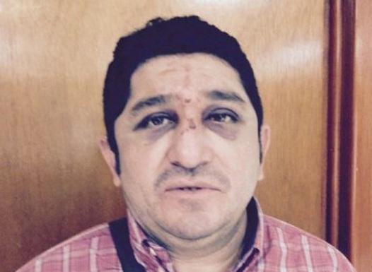 Golpean a periodista en Tabasco