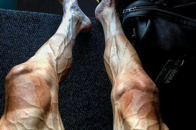 La impresionante imagen de las piernas del ciclista Pawel Poljanski durante el Tour de Francia