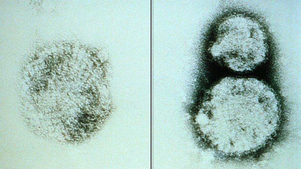 Hantavirus: cuáles son los síntomas de la enfermedad que ha causado la muerte de 9 personas en Argentina y 1 en Chile