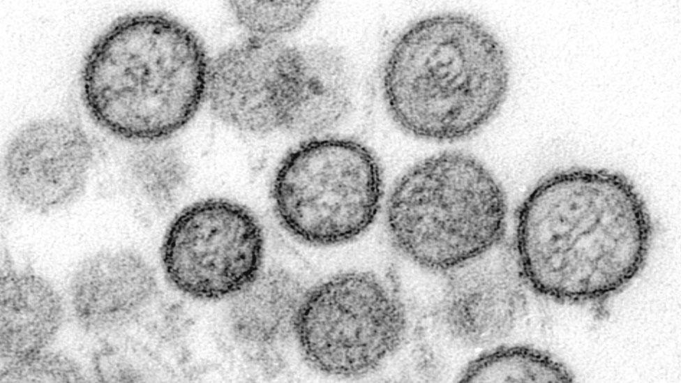 Hantavirus en Argentina: por qué preocupa el brote que ha causado la muerte de 9 personas