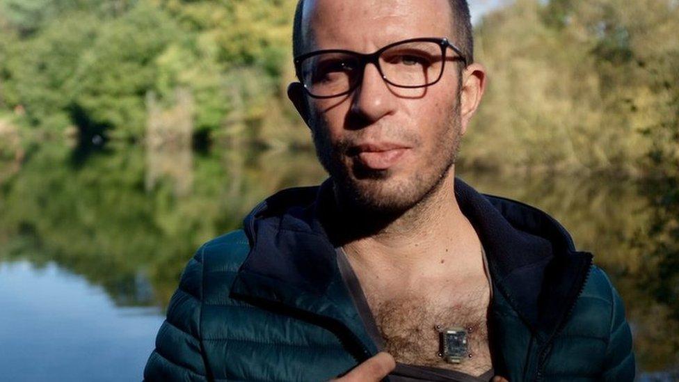 Los “biohackers” que transforman su cuerpo con implantes y dietas extremas: “He creado un nuevo sentido humano”