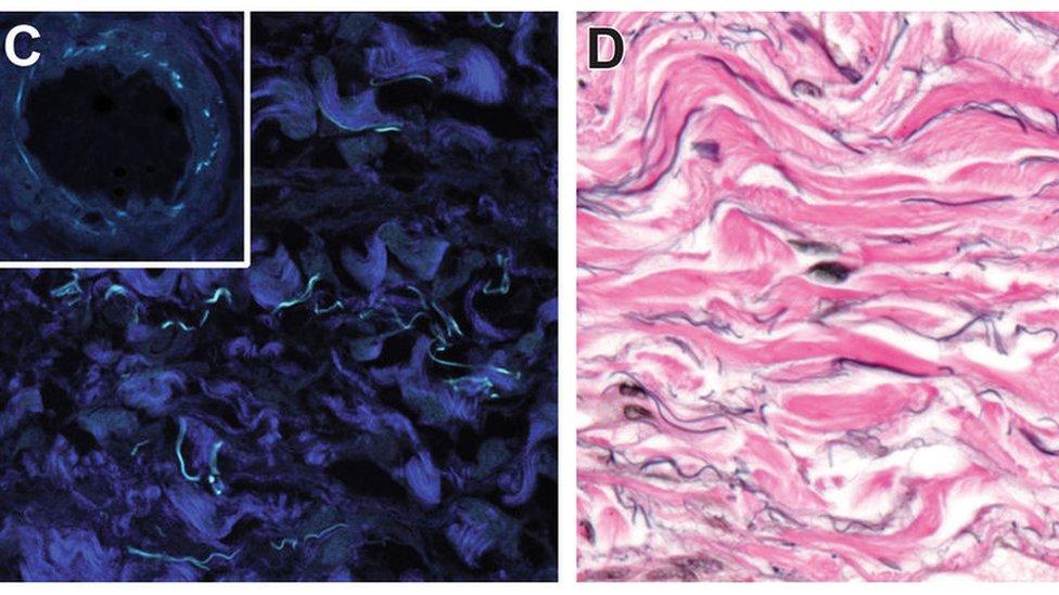 Intersticio, el órgano del cuerpo humano que la ciencia acaba de descubrir