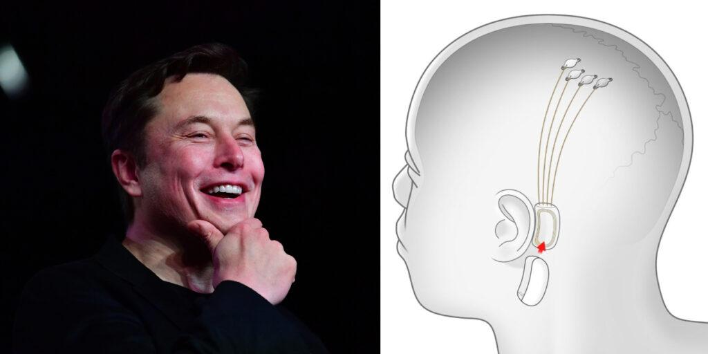 Neuralink Así Es El Proyecto De Elon Musk Para Conectar Nuestro