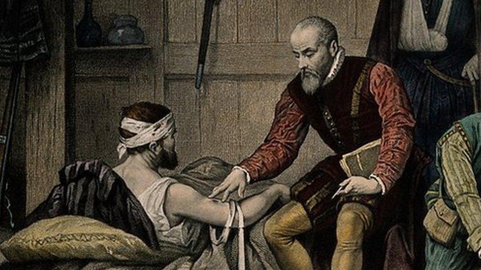 Ambroise Paré, el barbero convertido en médico de los reyes de Francia que cambió la cirugía para siempre