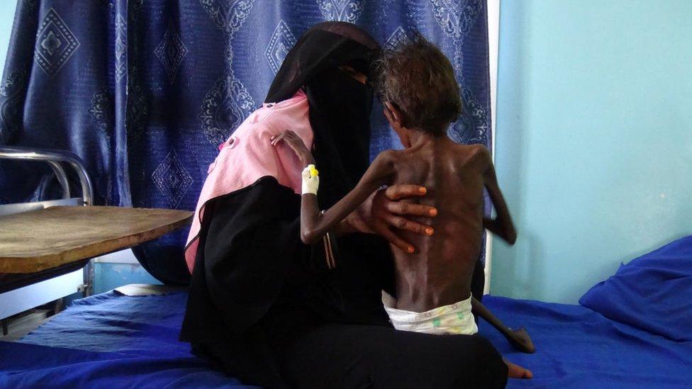 Guerra en Yemen: 3 condiciones para la paz en uno de los conflictos más sangrientos del mundo hoy