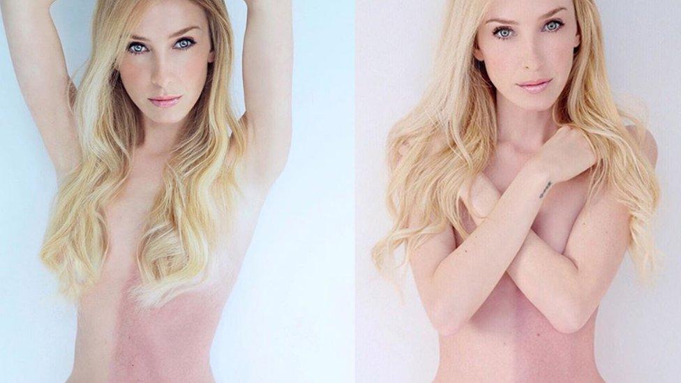 El quimerismo de Taylor Muhl, la modelo y cantante que absorbió a su hermana durante la gestación