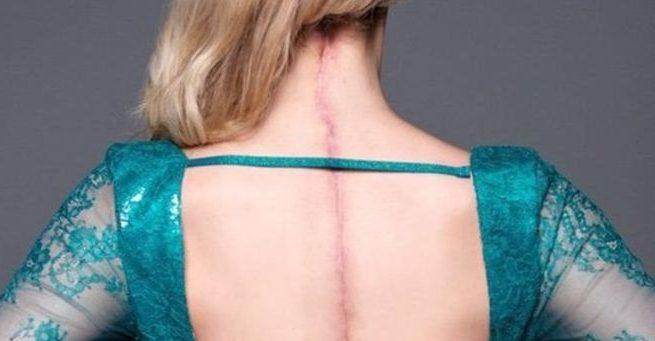 Tengo una enfermedad invisible: la reina de belleza con el Síndrome de Ehlers-Danlos