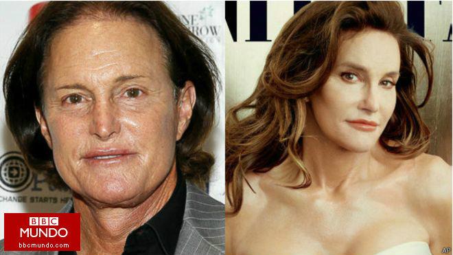 A propósito de Caitlyn Jenner: cómo se hace un cambio de sexo