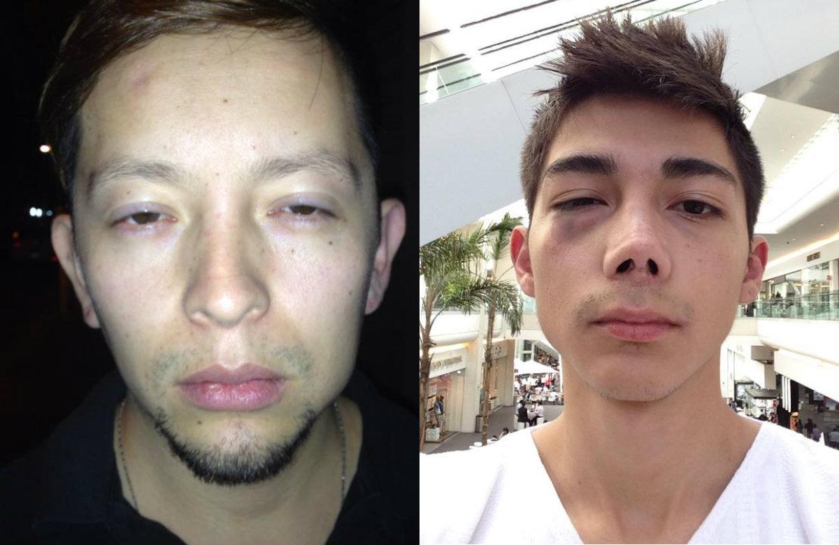 Aspirante a diputado del PT golpea y amenaza de muerte a pareja gay