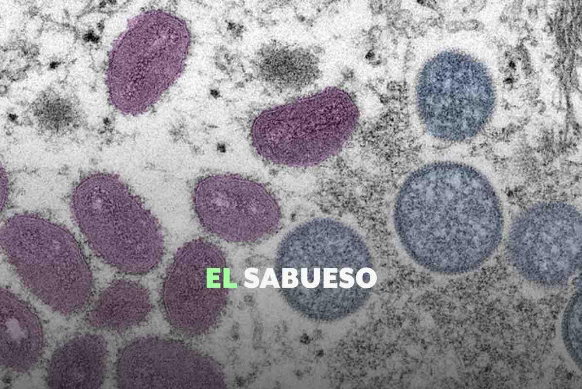 5 puntos clave para entender qué es el Mpox, causas, contagios y síntomas