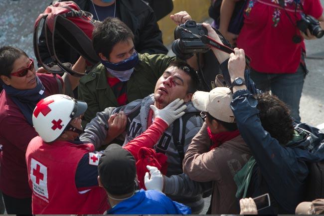 Trasladan a terapia intensiva a herido en San Lázaro