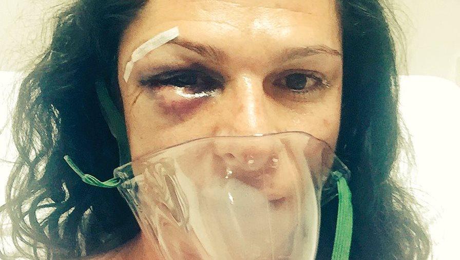 Identifican a 2 de los cuatro agresores de la senadora Ana Gabriela Guevara