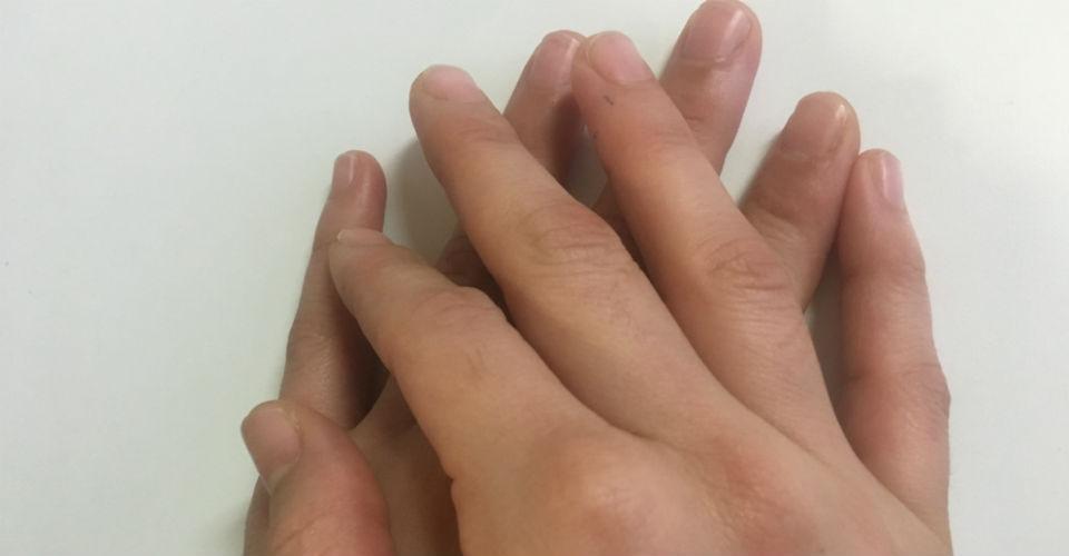Declaran exitoso el primer trasplante de manos a un niño en Estados Unidos