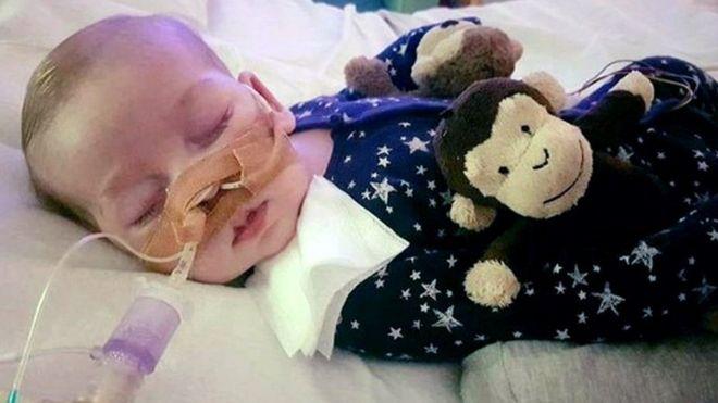 Padres del bebé inglés Charlie Gard ponen fin a la batalla para darle un tratamiento experimental