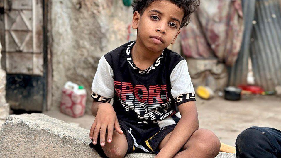 "Si el sufrimiento tuviera una dirección sería en Yemen": los niños de una olvidada guerra