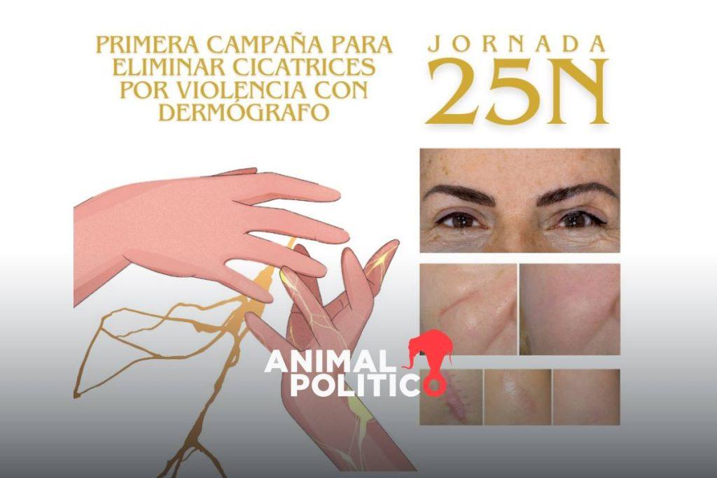 Mujeres de Veracruz buscan borrar las cicatrices que la violencia de género les dejó