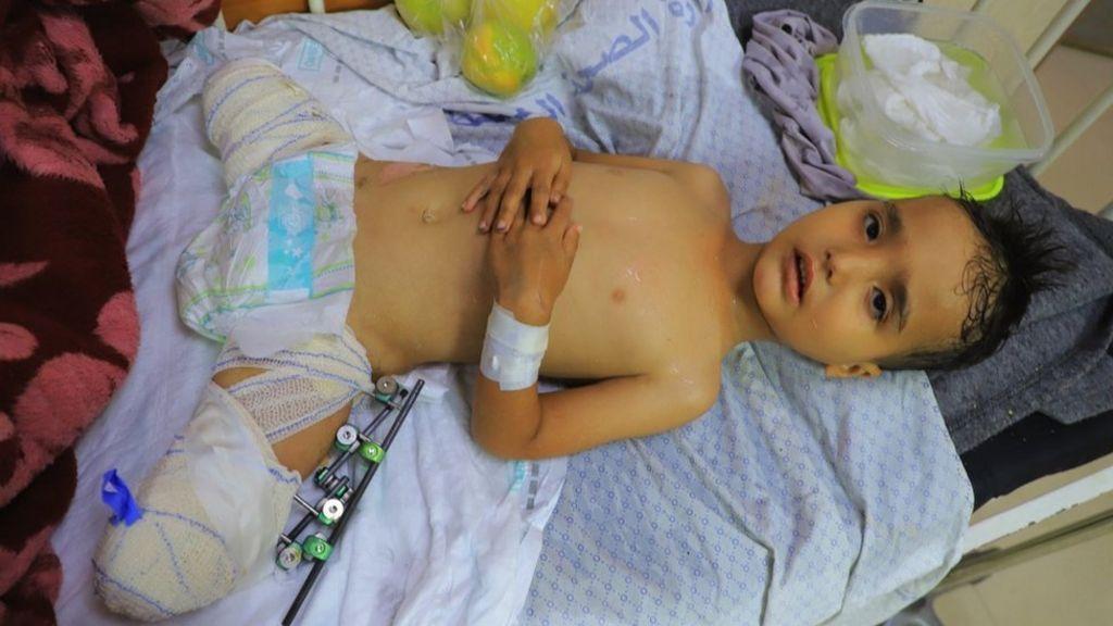 Heridos y solos: el dolor de los niños de Gaza que quedaron huérfanos