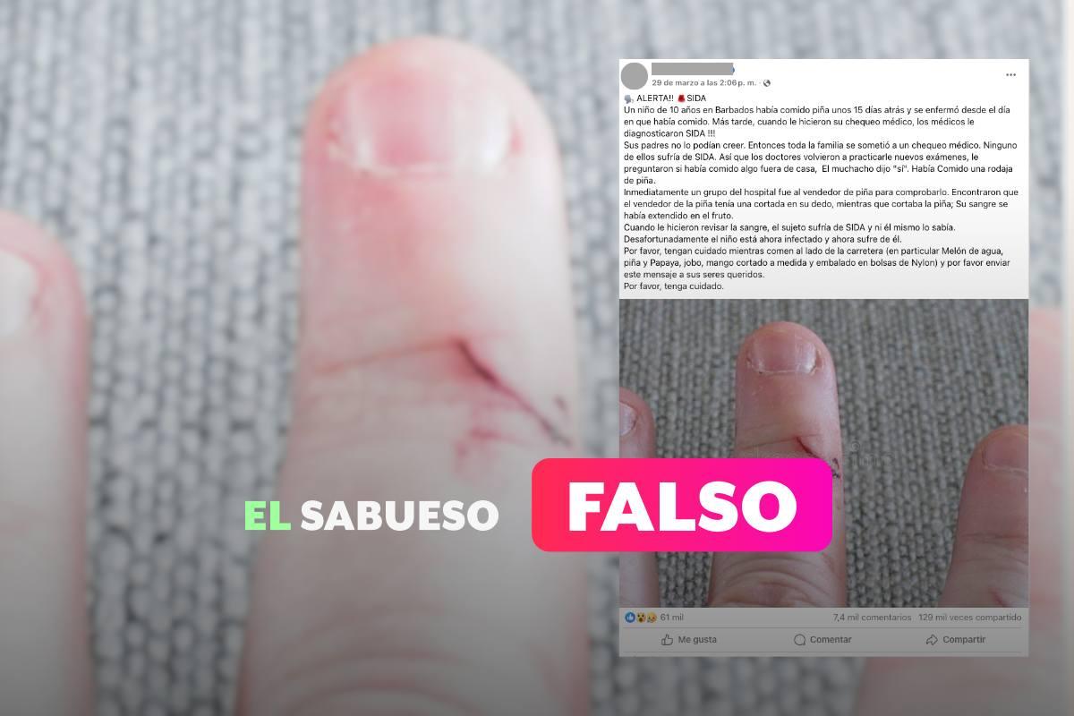 El ‘sida’ no se transmite por consumir alimentos contaminados