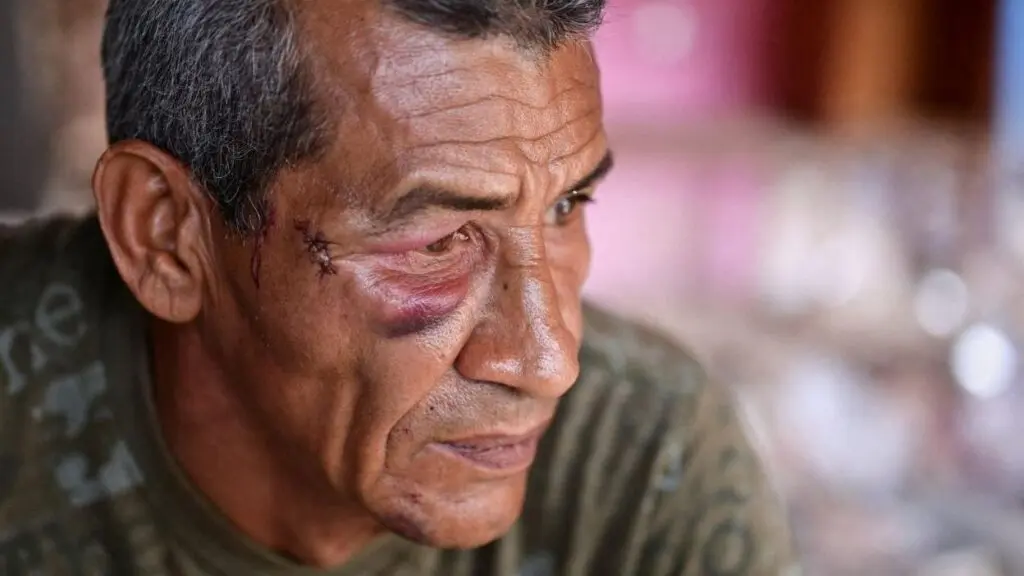 “Sentí que había muerto”: sobrevivientes relatan lo que vivieron durante el bombardeo de EU al Bloque 12 en Venezuela